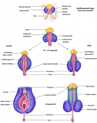 A medical diagram illustrating human genital development stages: undifferentiated (prior to 9th week), 9th-11th week (female…