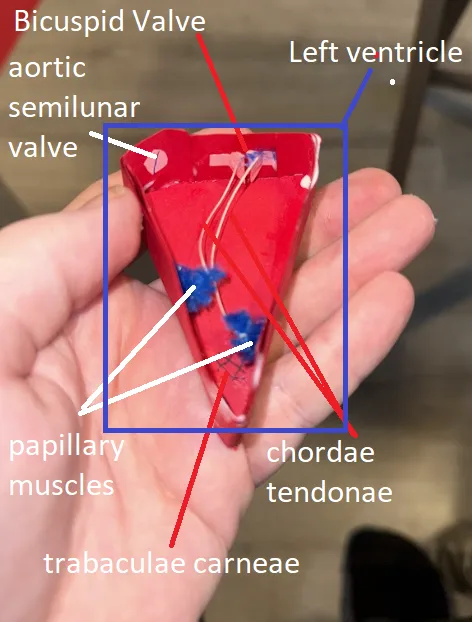 A hand holds a red anatomical model of a heart valve, with labels pointing to parts like 'Bicuspid Valve', 'Left ventricle'…