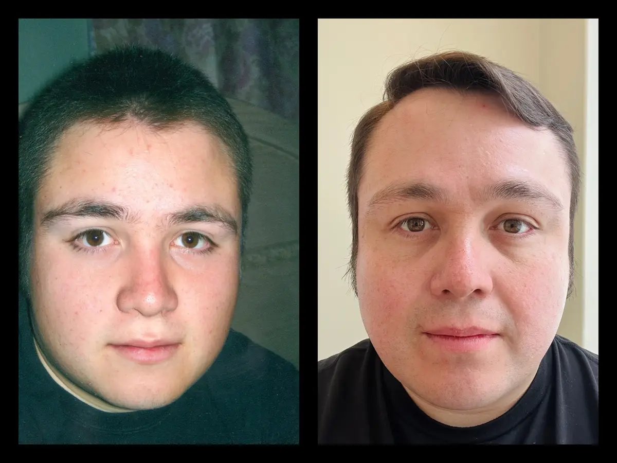 The 20-Year Challenge: Then vs. Now at 40