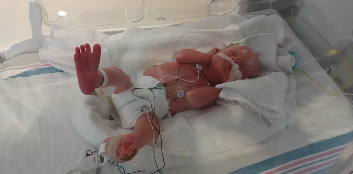 A newborn baby lies in a hospital incubator, connected to medical monitors with wires and sensors on its chest and foot, one…