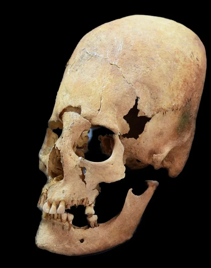 A weathered, cracked human skull with missing jawbone and teeth is shown against a black background. The overlaid text reads…