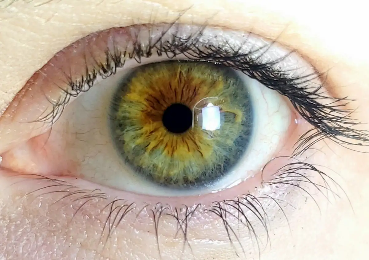 Finally Captured: The Clearest Shot of My Iris Yet