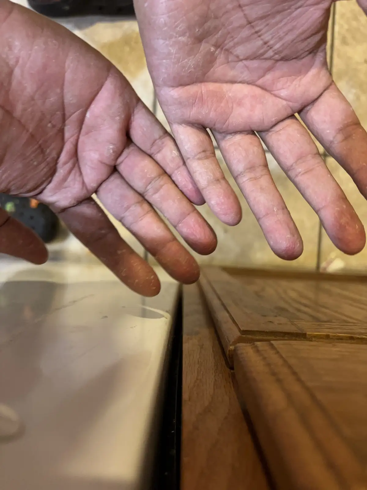 The Struggle is Real: My Hands in Action!