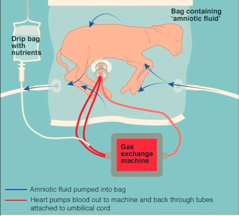 A diagram shows a fetus inside a transparent bag labeled 'Bag containing 'amniotic fluid'', connected by tubes to a 'Gas…