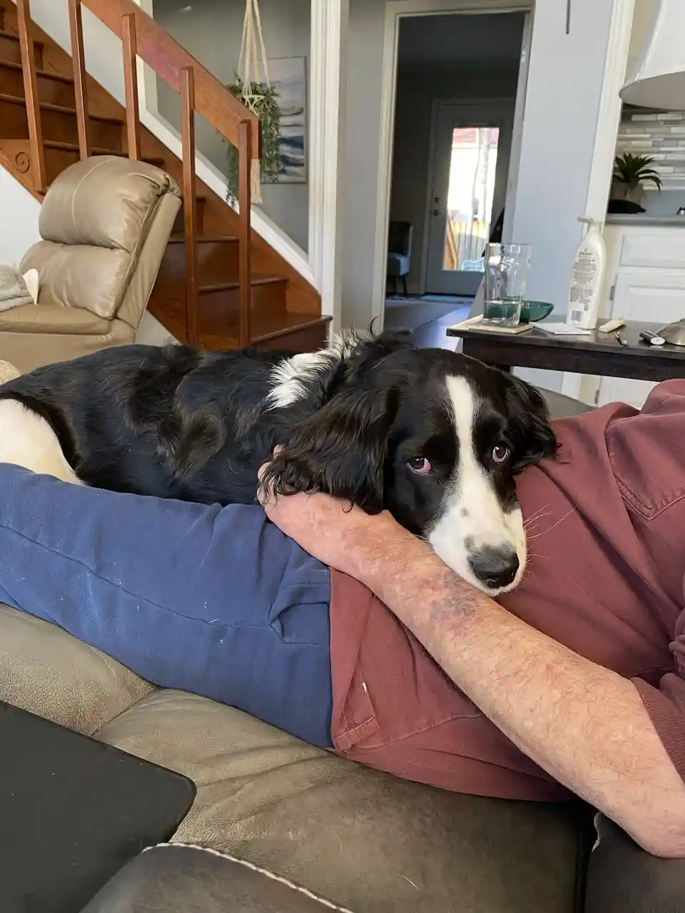 A black and white dog with a sad, tired expression rests its head on a person's arm while lying on a couch. The person is…